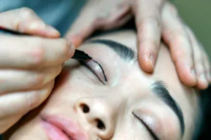 Blefaroplastia in Timisoara rejuvenare si 10 ani de tinerete